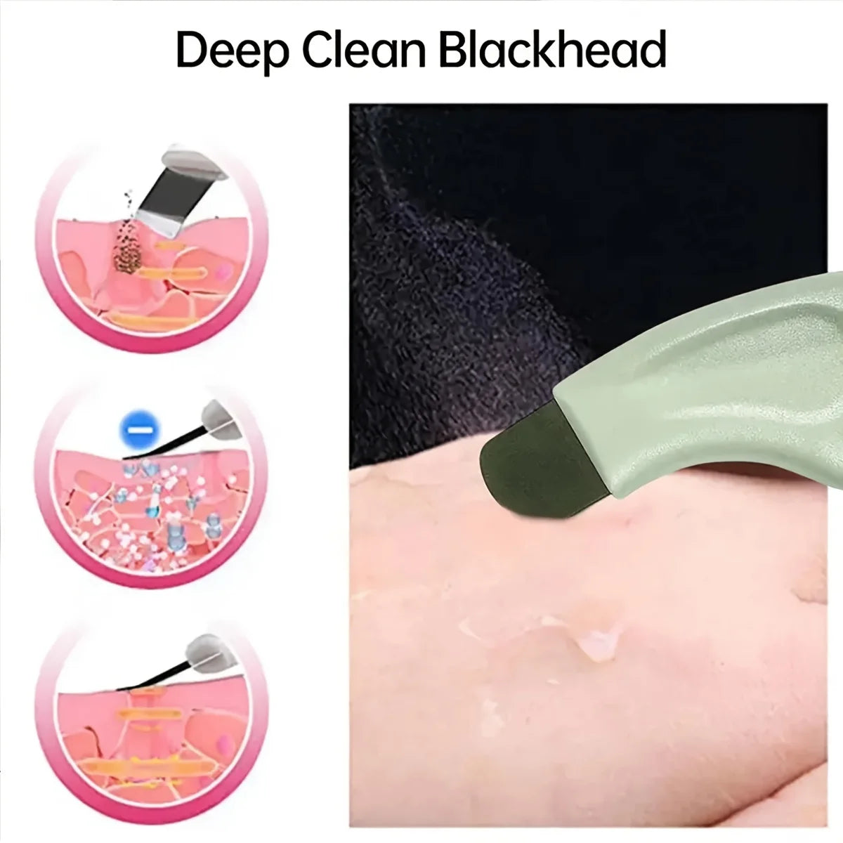 Deep Cleansing Facial Blackhead Removal Tool